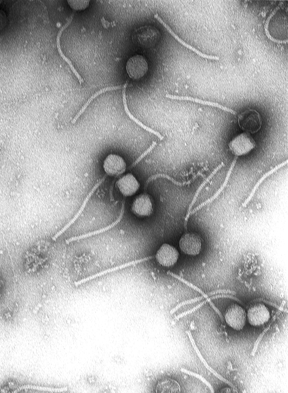 Gamma-Phagen im Transmissionselektronenmikroskop (TEM) nach Negativkontrastierung (Computergeneriertes Bild)