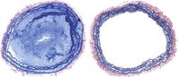 Das Bild links zeigt ein Blutgefäß mit Blutpfropf beim Wildtyp, das Bild rechts das Blutgefäß von einer Mutante ohne Kindlin-3-Protein - hier bildet sich kein Blutpfropf. Bild: MPI für Biochemie